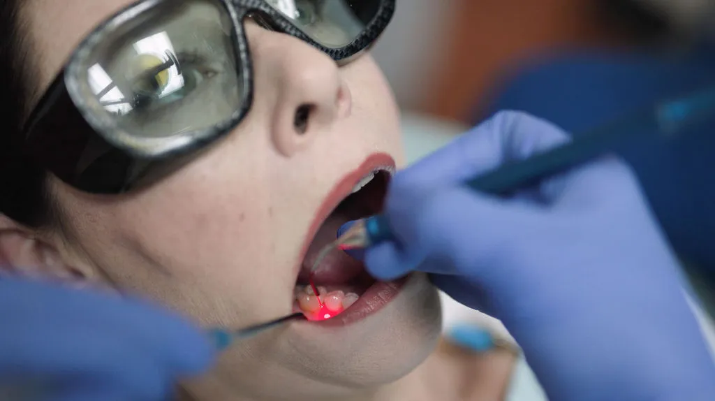 laser treatment